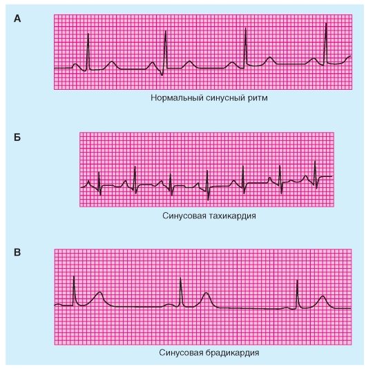 Как посчитать пульс, по какой формуле, какая максимальная частота сердечных сокращений в минуту у человека